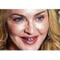 Madonna e i denti-gioiello, grillz-mania